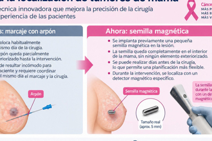 Sierrallana introduce semillas magn�ticas para mejorar la precisi�n de la cirug�a del c�ncer de mama