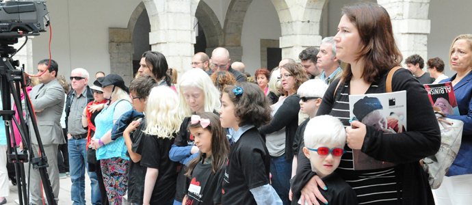 El albinismo, protagonista en el Parlamento de Cantabria 