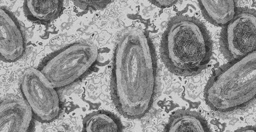 Cantabria mantendr el protocolo de vigilancia, deteccin y determinacin de la variante ya establecida para la viruela del mono