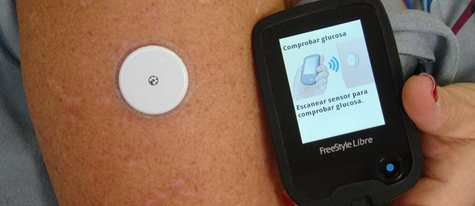 Cantabria, primera CCAA en proporcionar sistemas de monitorizacin continua de glucosa a pacientes con diabetes tipo 1