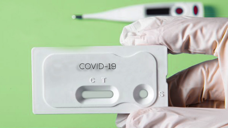 Cantabria recibe 9.600 test rpidos para el diagnstico precoz del Covid-19