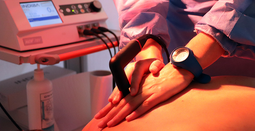 Experimenta los beneficios de la terapia Indiba Activ y la puncin seca en Centro Mdico Ro Ebro