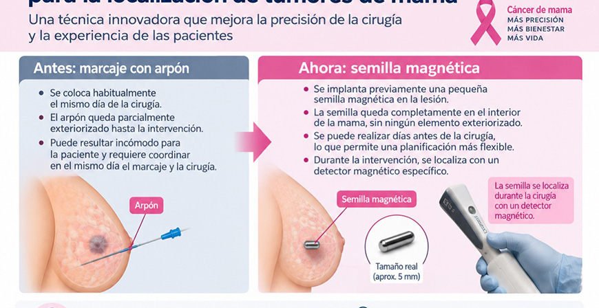 Sierrallana introduce semillas magn�ticas para mejorar la precisi�n de la cirug�a del c�ncer de mama